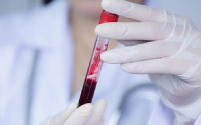 Profesionales concientizan sobre la leucemia y enfermedades de la sangre