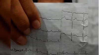 Denuncian estudios irregulares en controles escolares