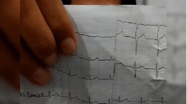 Denuncian estudios irregulares en controles escolares