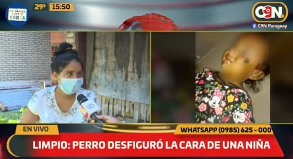 Niña de un año queda con rostro desfigurado tras ataque de can