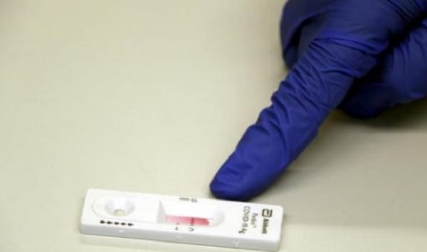 Confirman tres casos importados de Ómicron en Paraguay