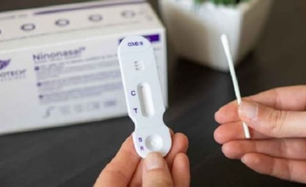 Farmacias solo pueden vender autotest y no test rápido, aclaran