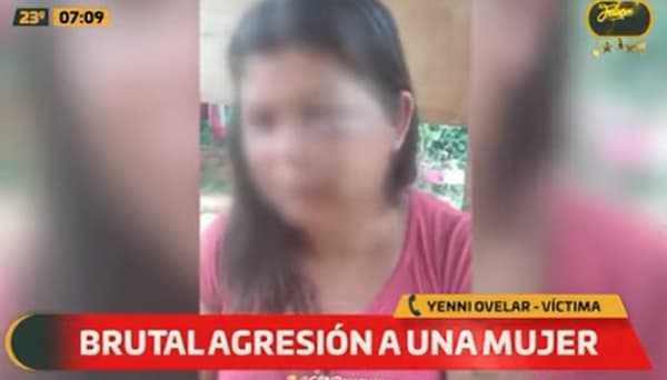 Mujer denuncia ataque por parte de su hermana y pareja en Areguá
