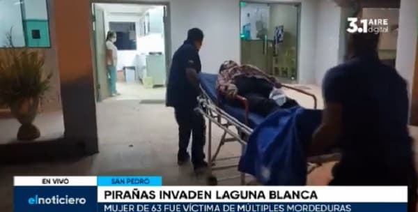 Mujer pierde cuatro dedos de los pies en ataque de pirañas en Laguna Blanca