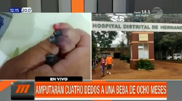 Amputarán cuatro dedos a beba de ocho meses y padres denuncian negligencia