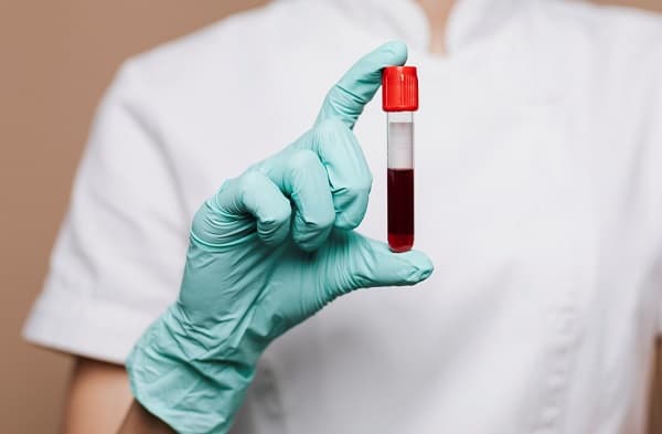 Cáncer de la Sangre: Instan a la detección temprana para luchar contra el mal