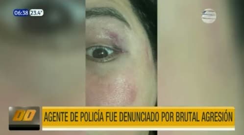 Denuncian a policía por brutal agresión a su expareja en Luque