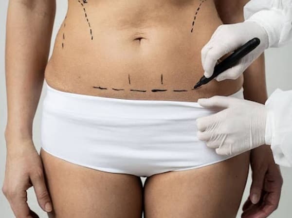 ¡Cuidado con las “clínicas estéticas”! Nueva denuncia de mala praxis en Alto Paraná