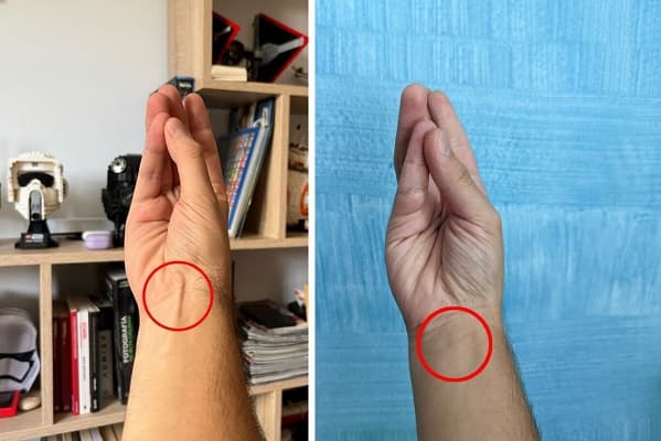 El músculo que la evolución está borrando del 14% de los humanos