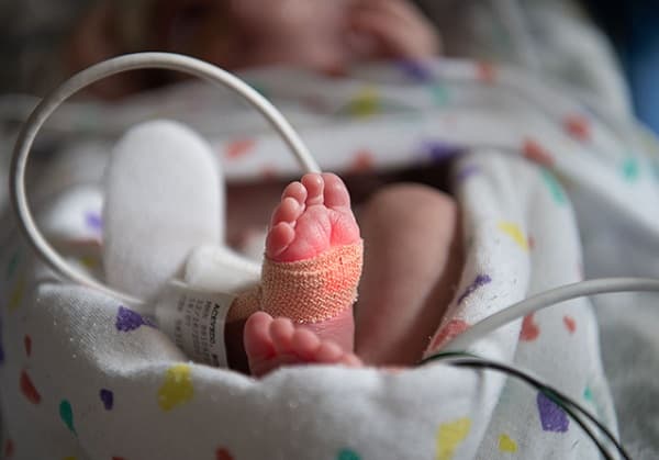 Dengue causa muerte de bebé prematura