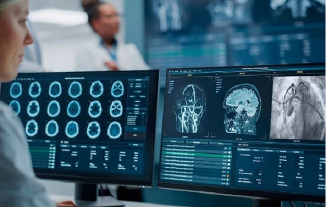 Software con IA promete mejorar diagnóstico de ACV