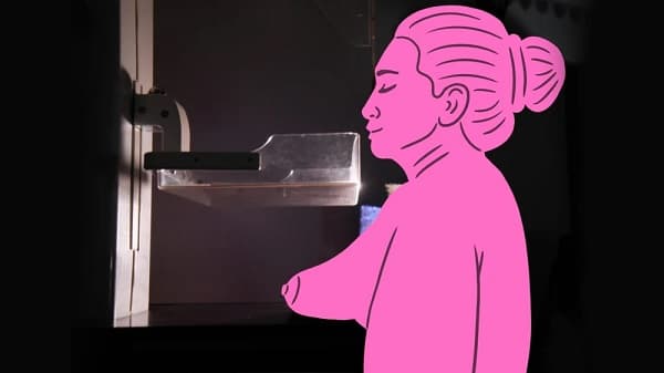 Alarma en Paraguay: 10 mujeres mueren cada semana por cáncer de mama