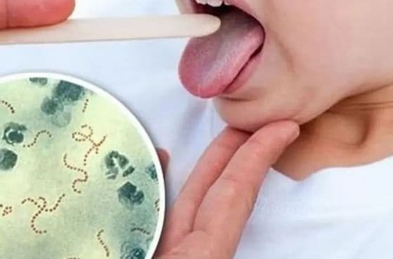 Bacteria estreptococo: qué es, síntomas y cómo prevenirla