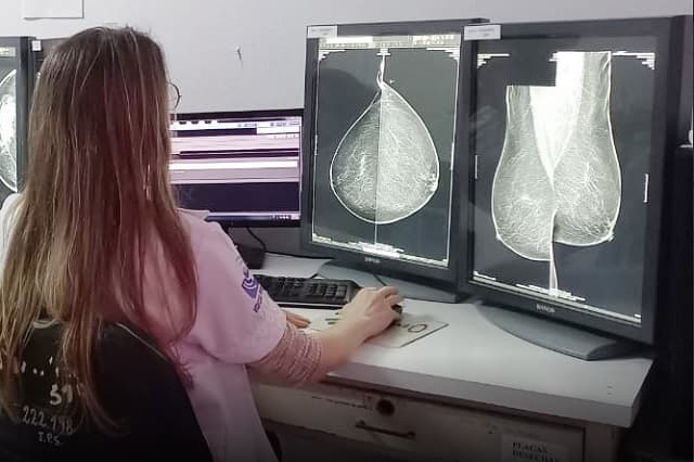 Nuevos mamógrafos impulsan detección temprana de cáncer