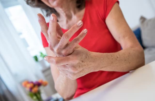 Nuevos tratamientos orales para la artritis reumatoide