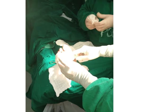 Tratamiento con larvas evita amputaciones en pacientes diabéticos