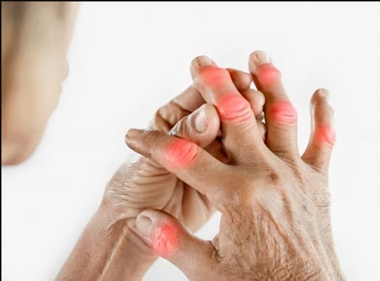 Invierno y artritis reumatoide: cómo proteger las articulaciones del frío