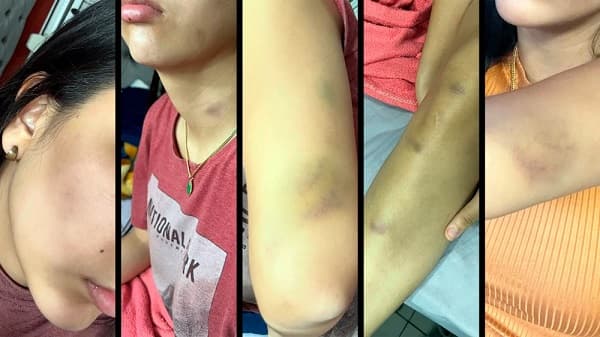 Modelo denuncia violencia de parte de funcionario judicial